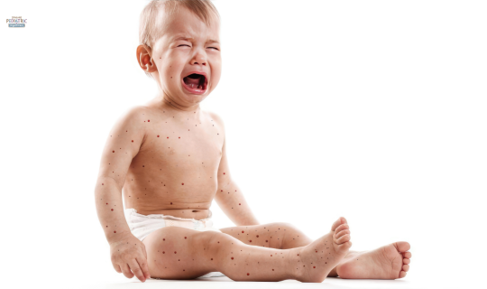 childhood rashes Spokane