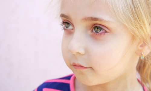 pink eye in kids